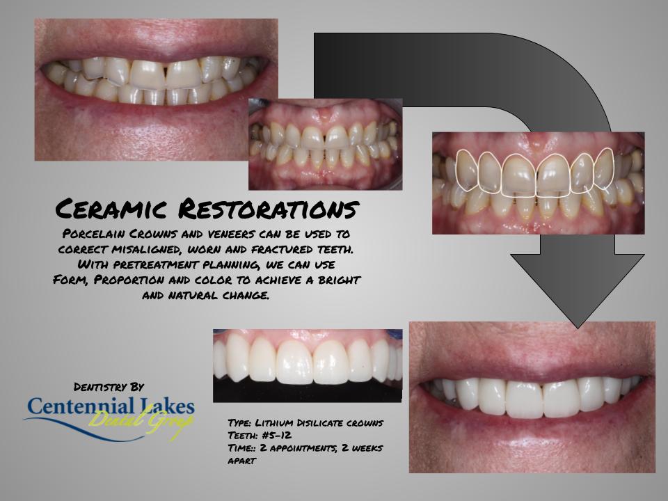 Centennial Lakes Dental Group photo 4