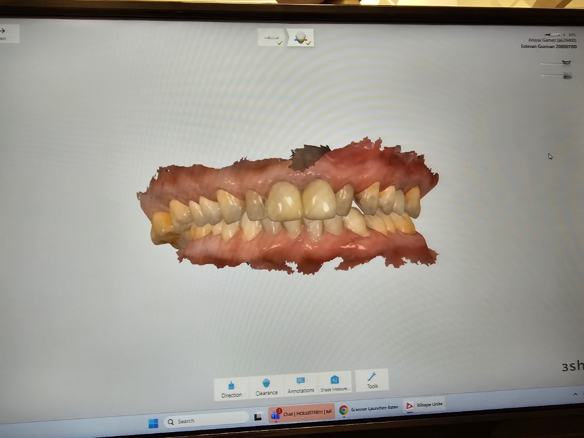 Aspen Dental - Hollister, Ca photo 5