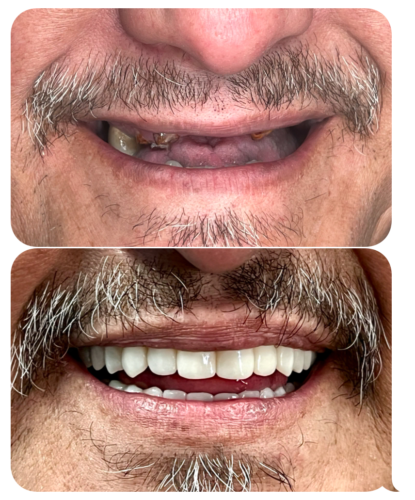 Manteca Dentistry And Implants photo 5