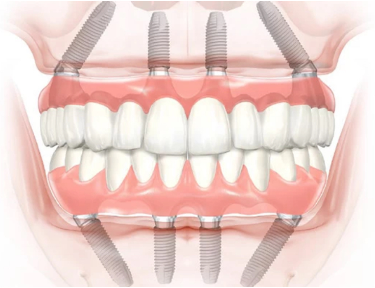 Manteca Dentistry And Implants photo 6