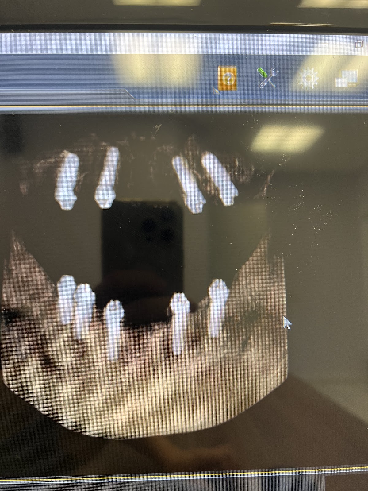 Affordable Implant Choice Center Dallas photo 6