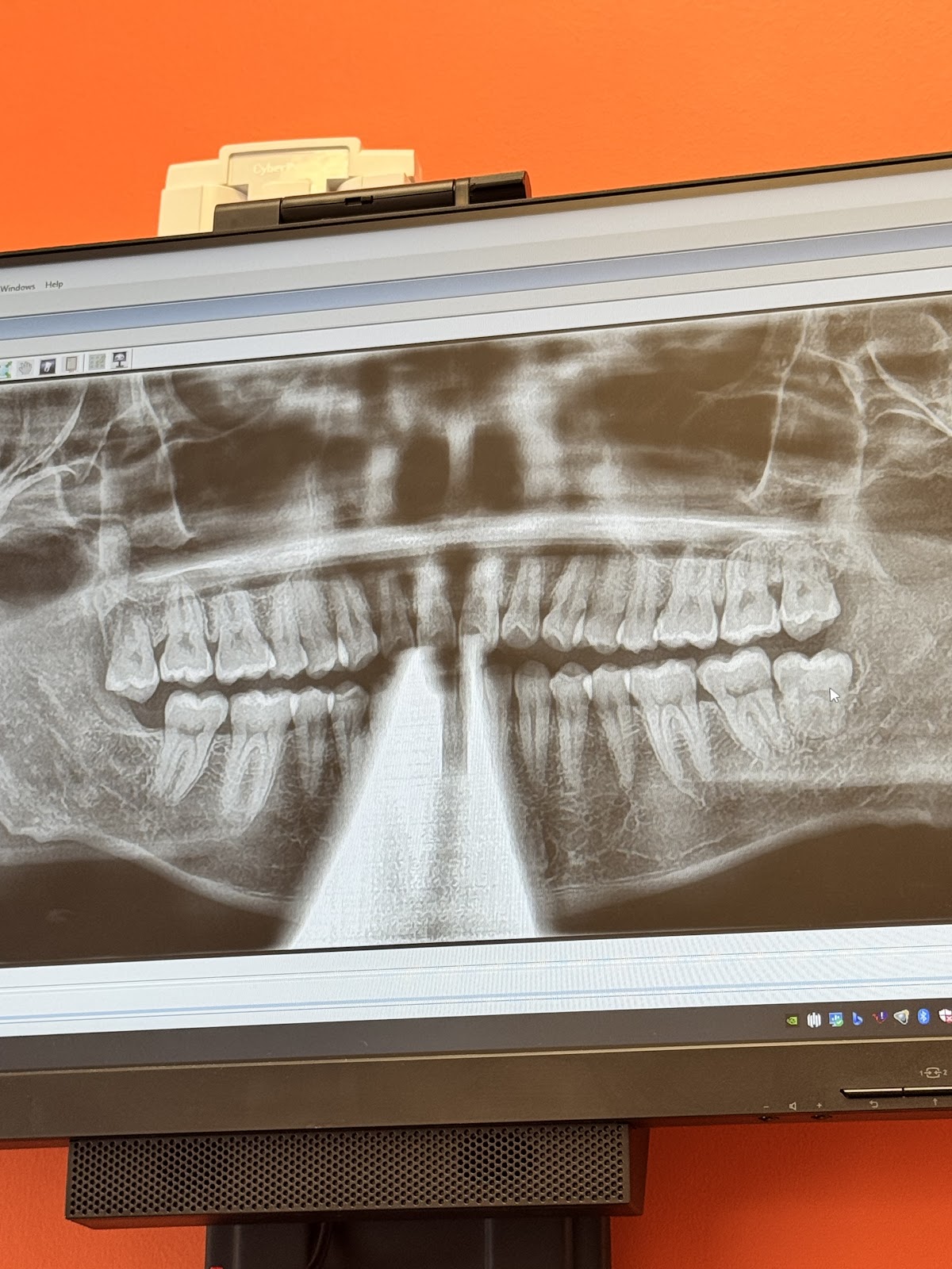 Northern Virginia Oral Surgery Centers: Falls Church photo 3