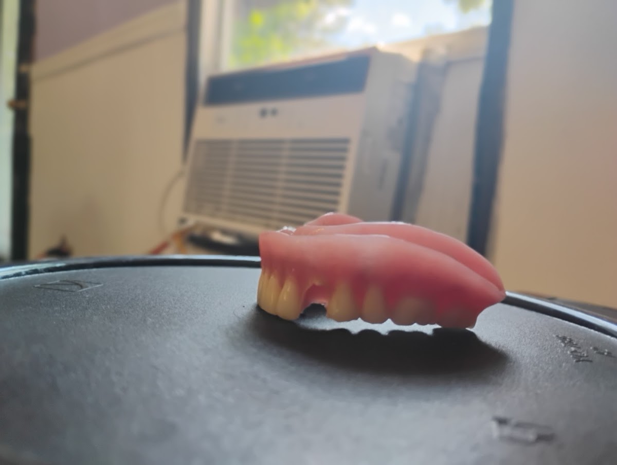 Aspen Dental - Calhoun photo 4