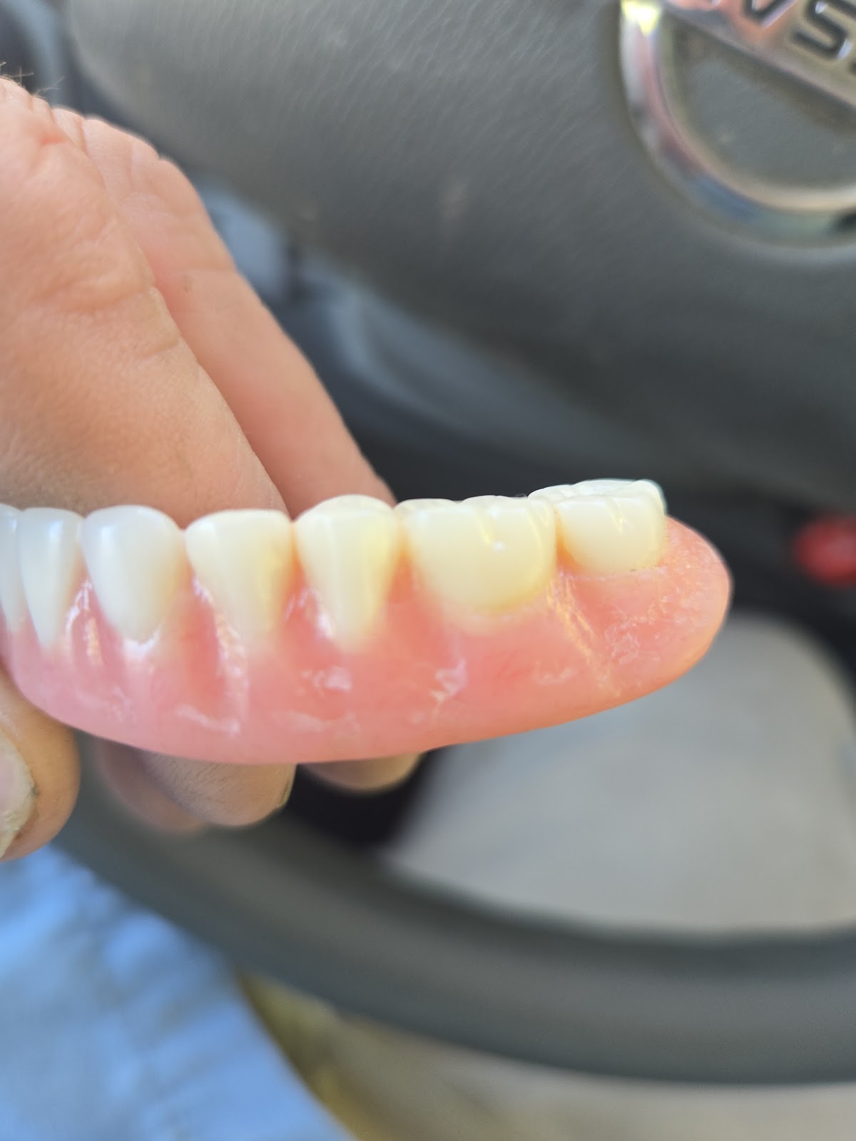 Aspen Dental - Calhoun photo 6