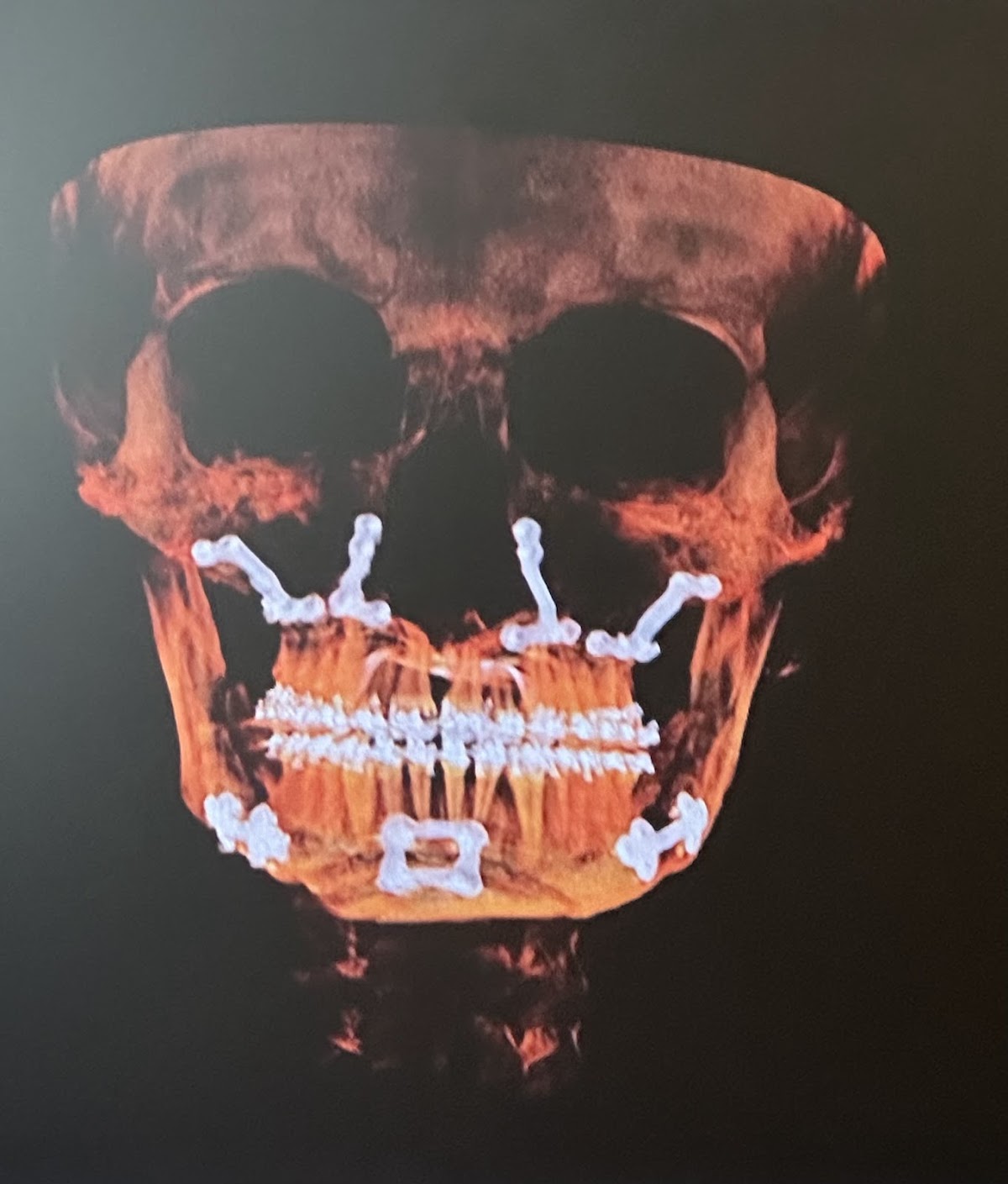 Matouk & Guevara Implant & Facial Surgery photo 3
