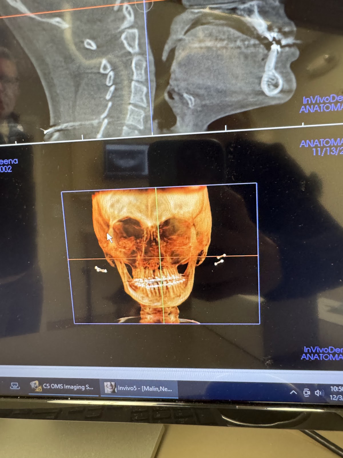 Matouk & Guevara Implant & Facial Surgery photo 4