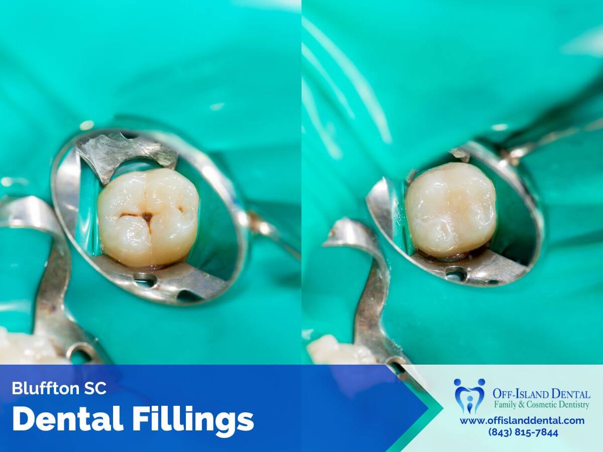 Off Island Dental Care photo 1