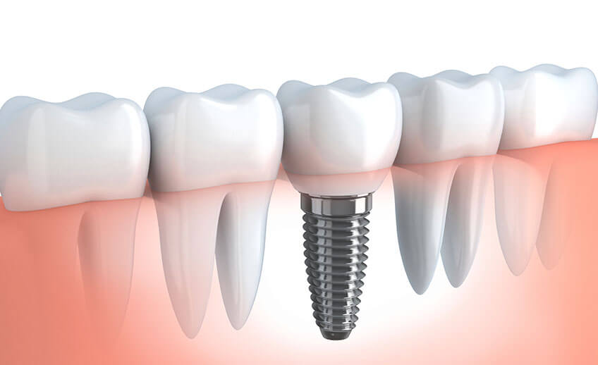 Off Island Dental Care photo 4