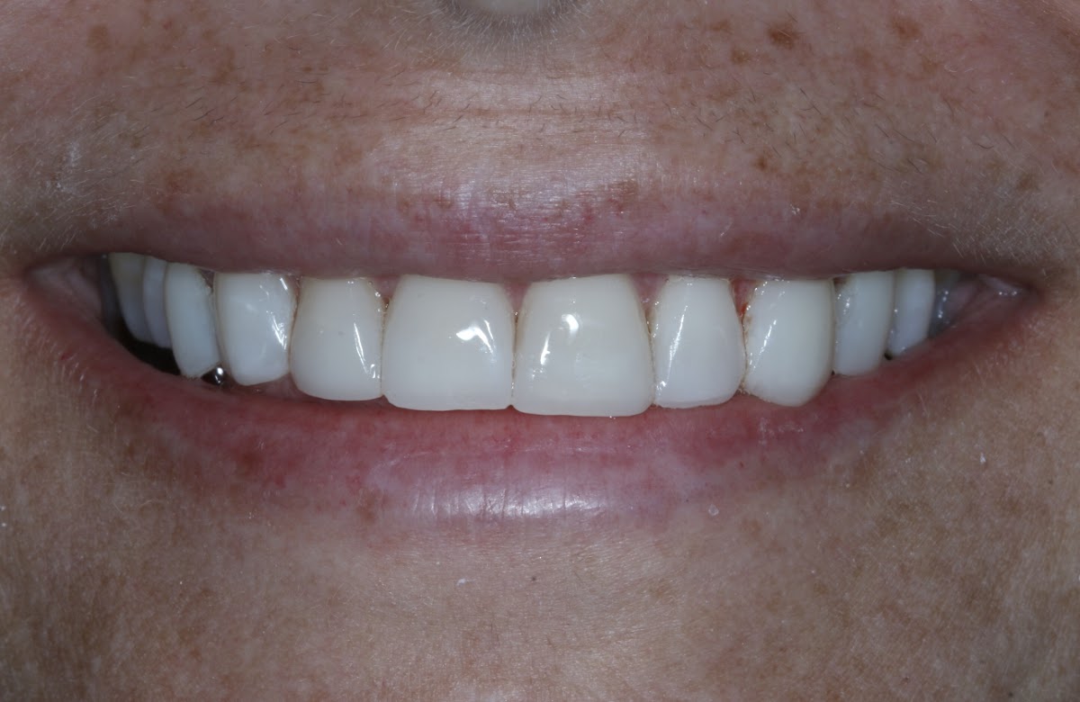 Lakewood Dental Associates photo 2