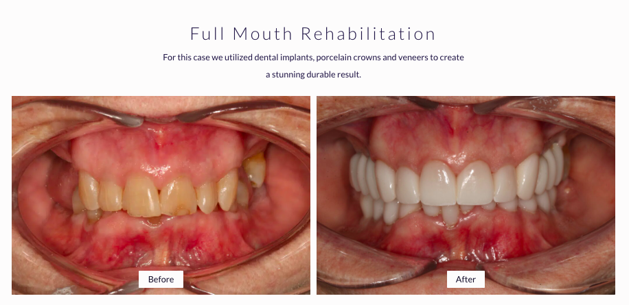 Lakewood Dental Associates photo 5