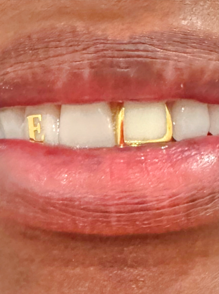 Flash Dental photo 3