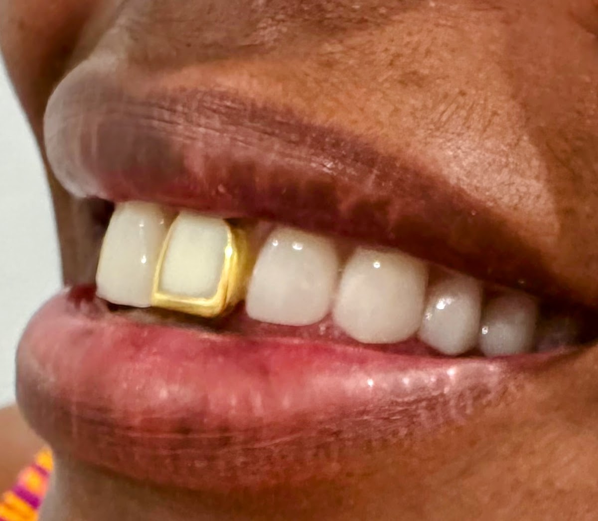 Flash Dental photo 6