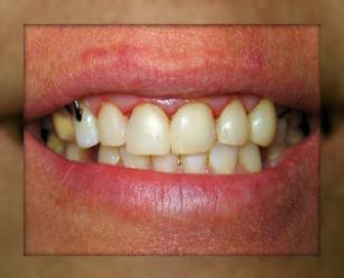 Advanced Dental Care photo 2