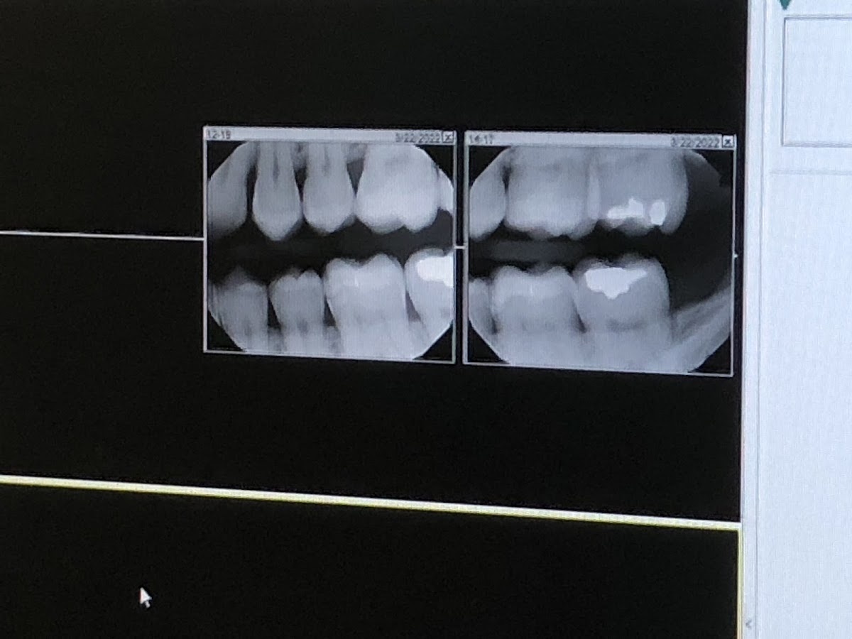 Advanced Dental Care photo 6