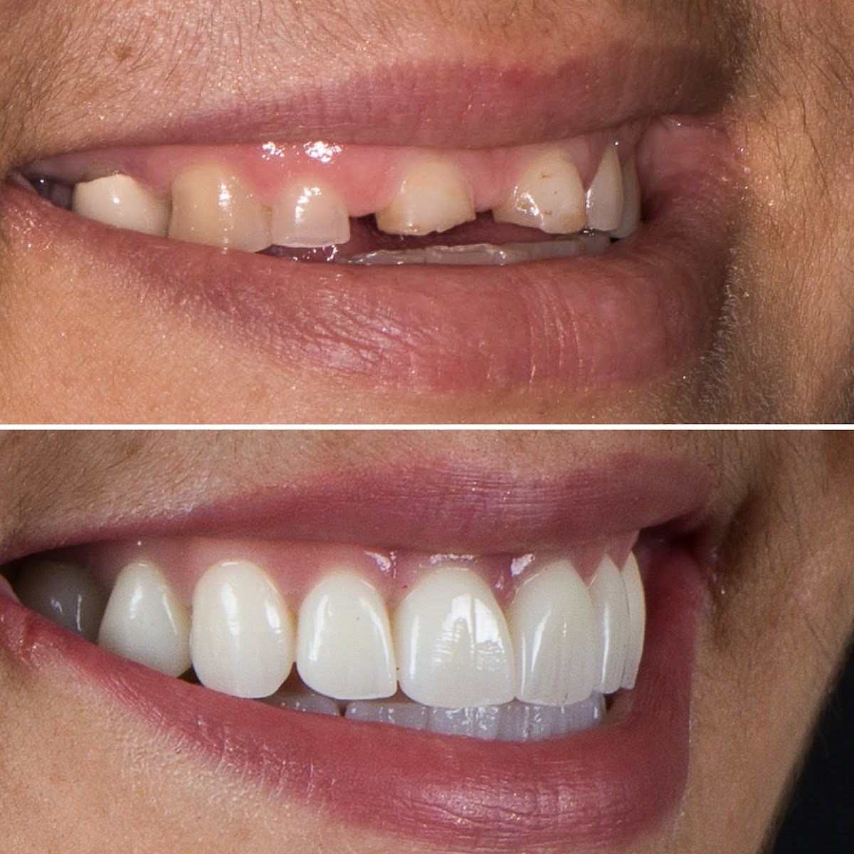 Advanced Prosthodontics & Implant Esthetics photo 5