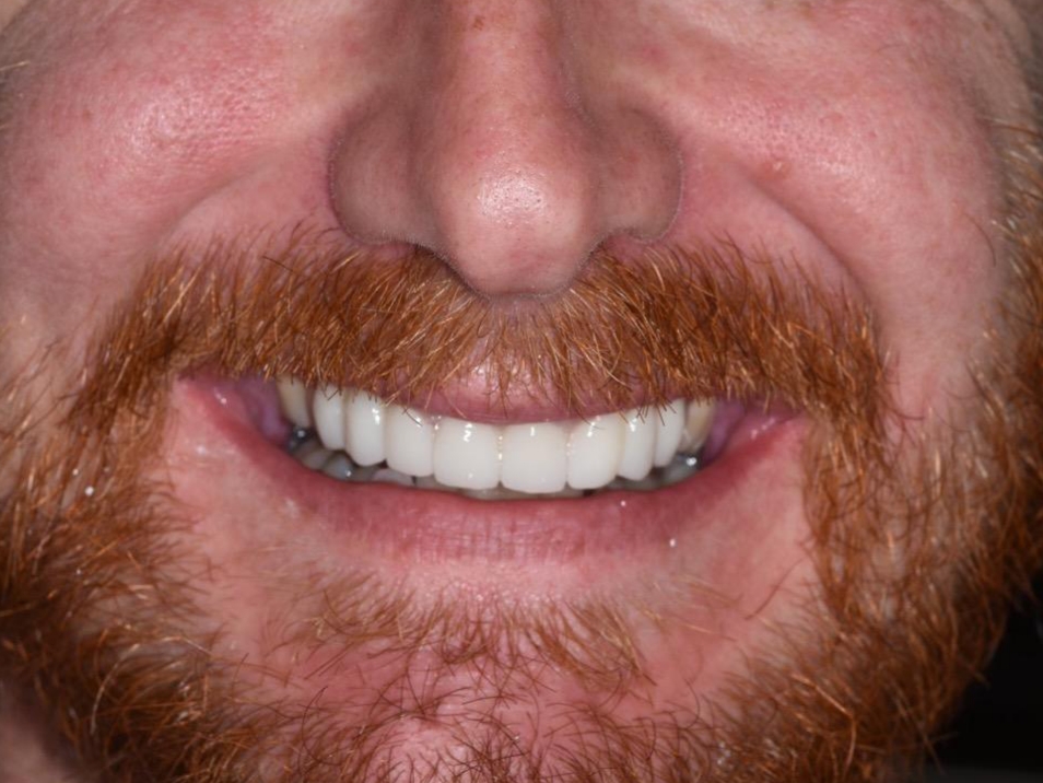Dr. Ralff Center for Cosmetic & Implant Dentistry photo 6