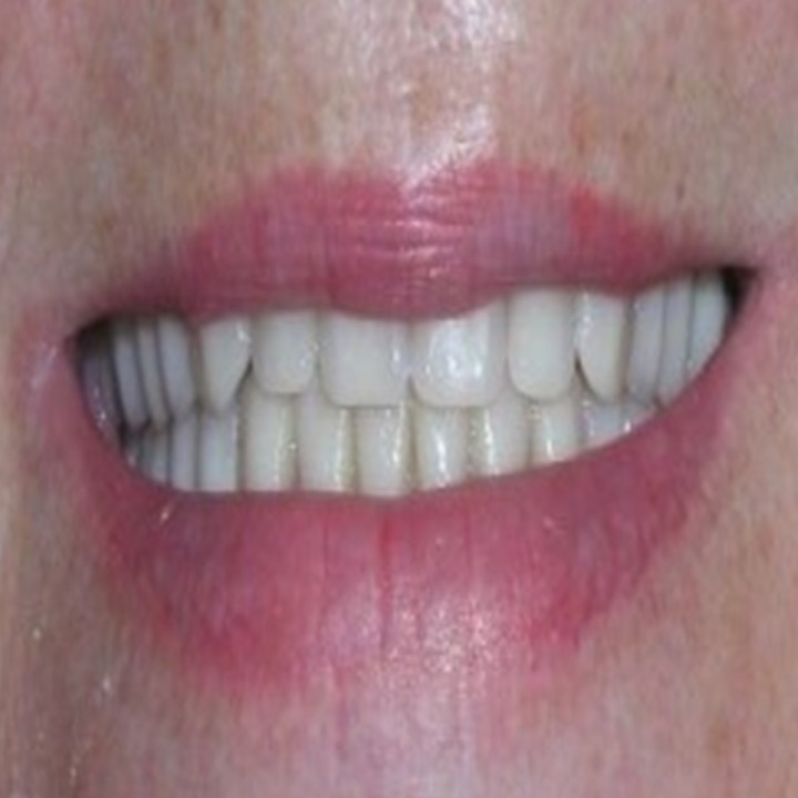 Comfortable Dentistry 4u photo 2