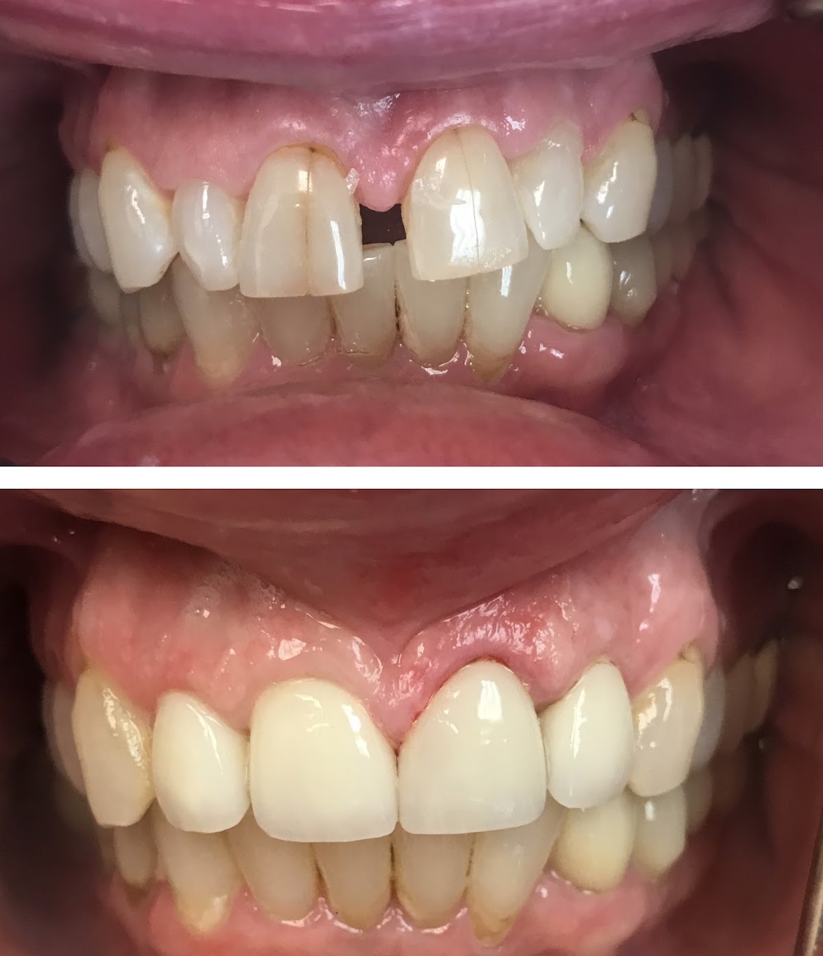 Central Valley Dentistry & Implants photo 2