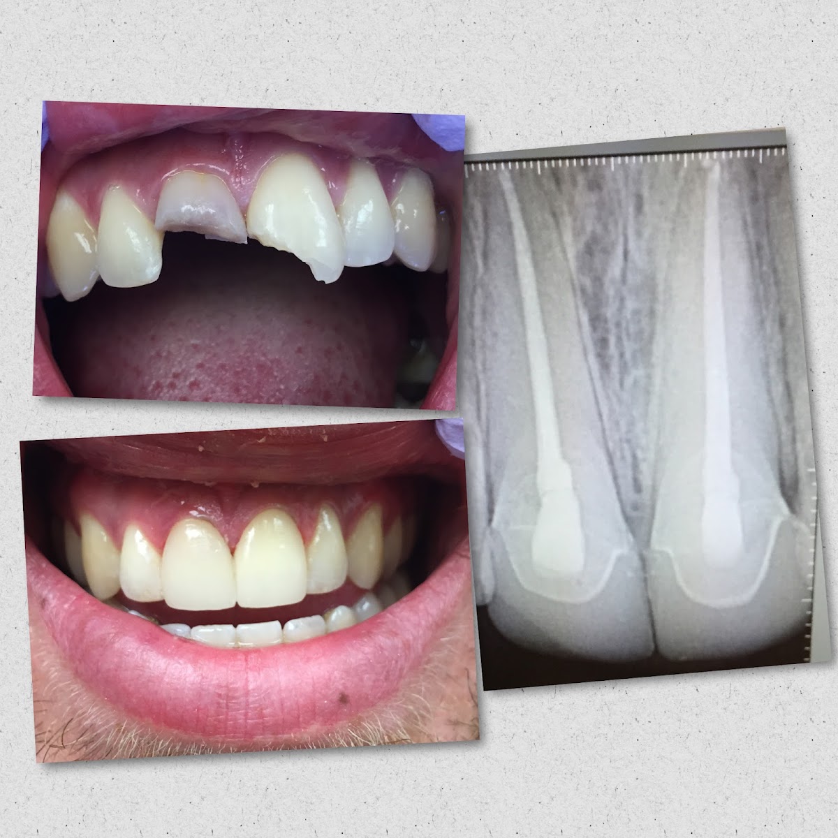 Central Valley Dentistry & Implants photo 3