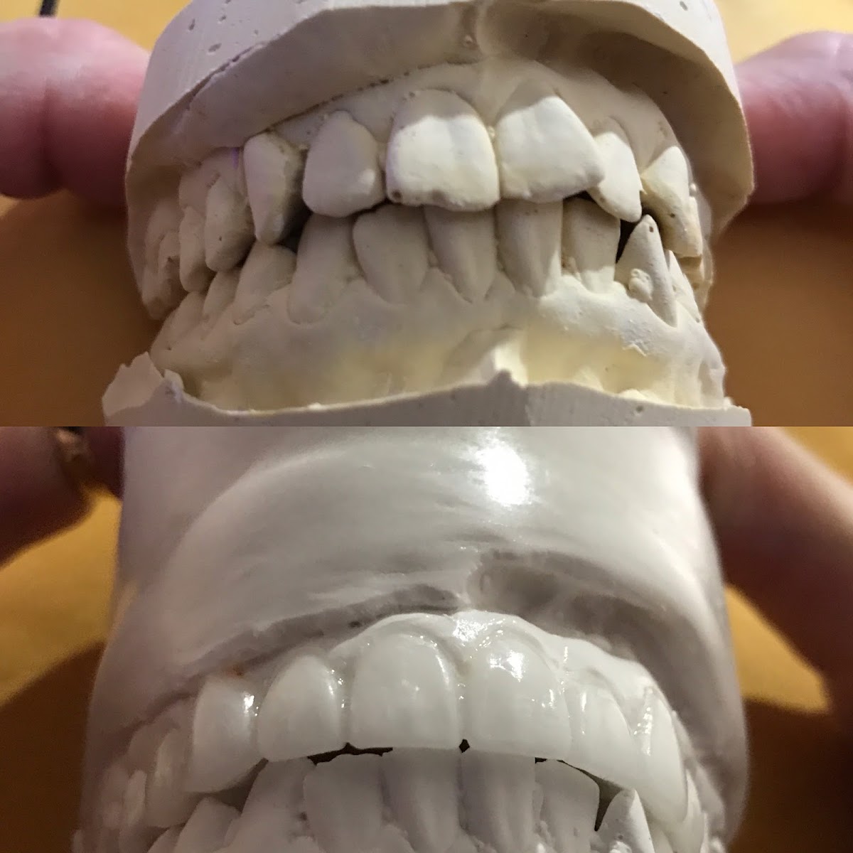 Central Valley Dentistry & Implants photo 4
