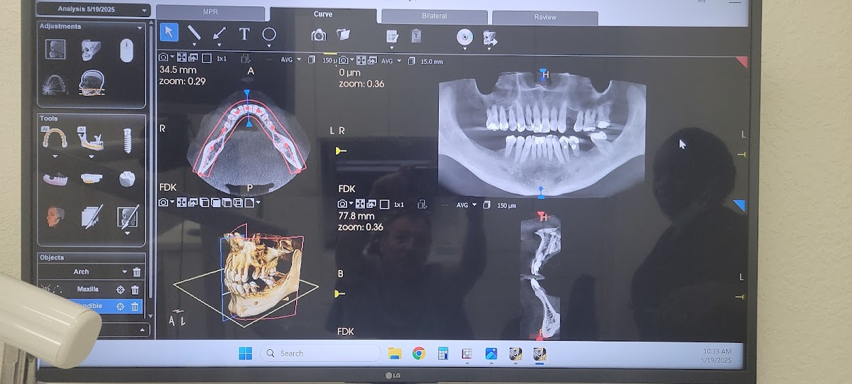 Best Value Dentures and Implants Tamarac photo 1