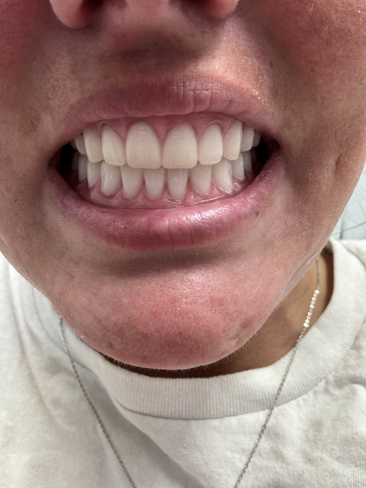 Affordable Dentures & Implants - Midlothian photo 4