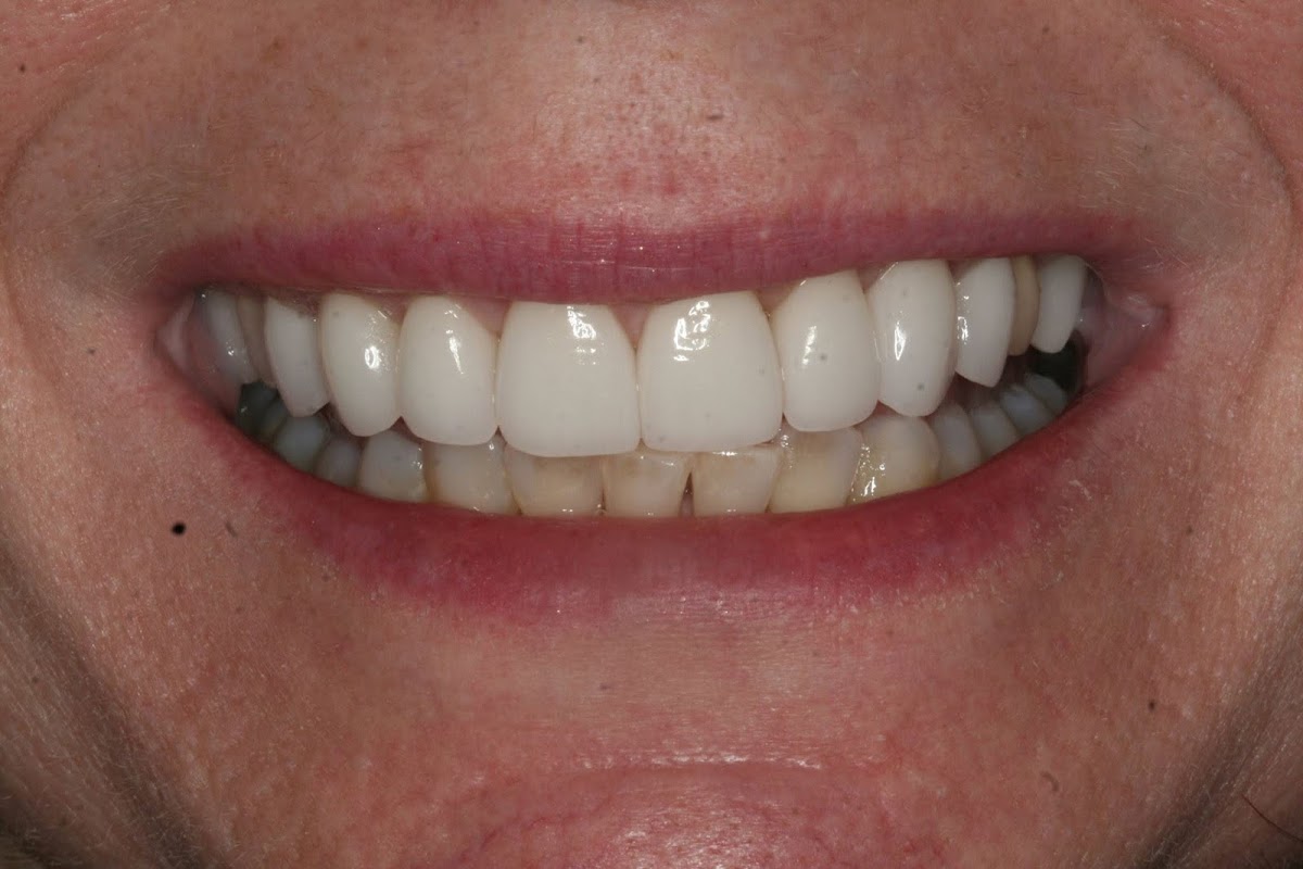 The Dental Design Center - Cosmetic, Implant & General Dentistry photo 5