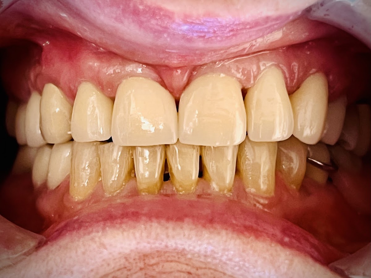 Downey Dental Solutions photo 2