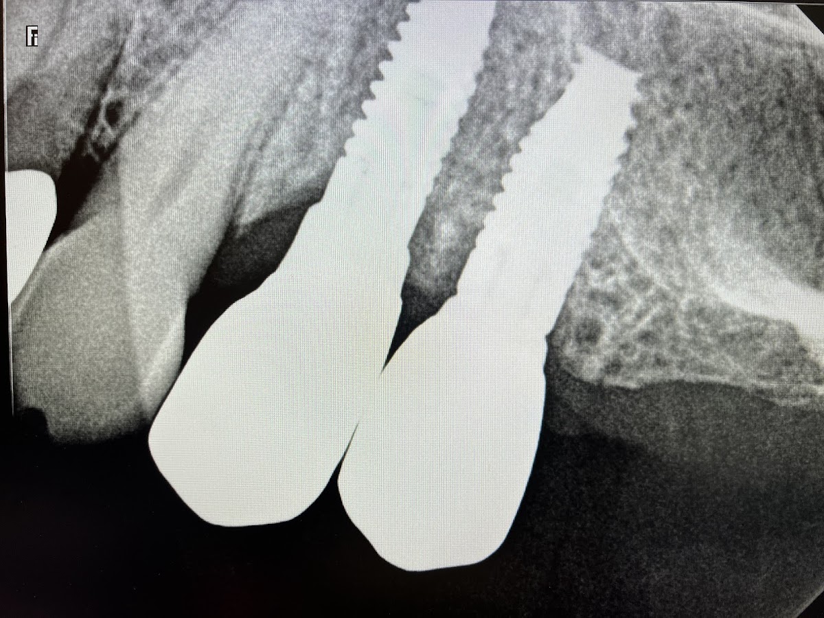 Downey Dental Solutions photo 3