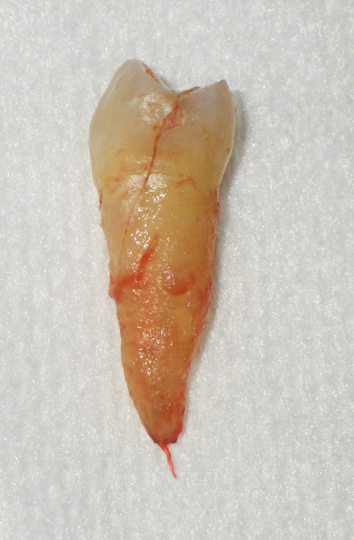 Downey Dental Solutions photo 5