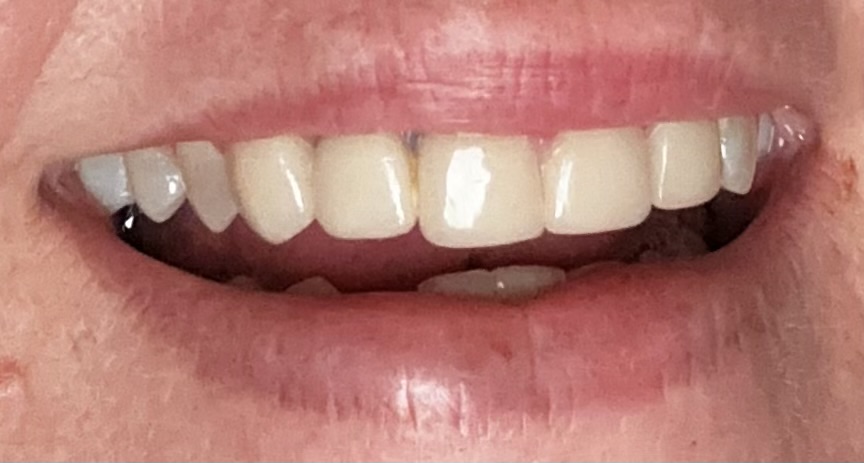 Smilepoint Dental & Orthodontics photo 6