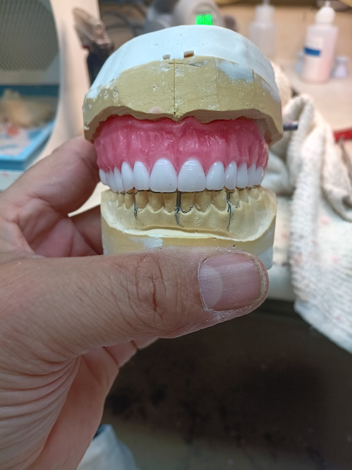 Affordable Dentures & Implants - Vineland photo 4