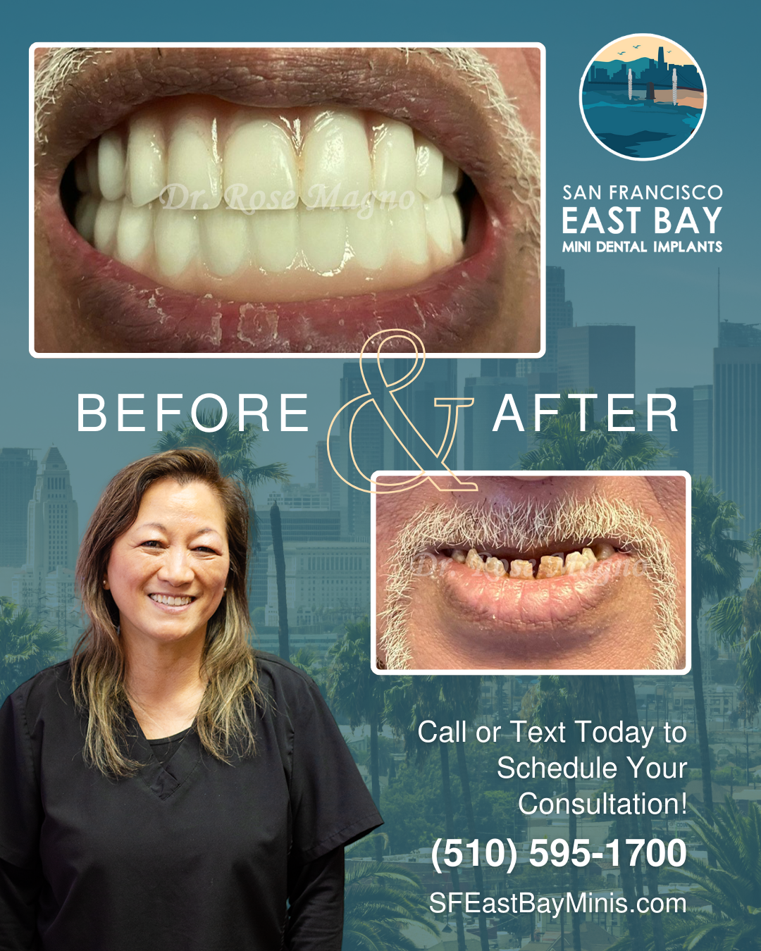 Sf East Bay Mini Dental Implants photo 6