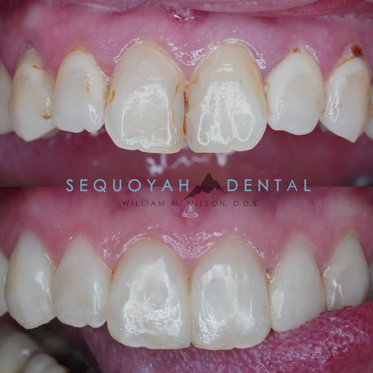 Sequoyah Dental photo 2