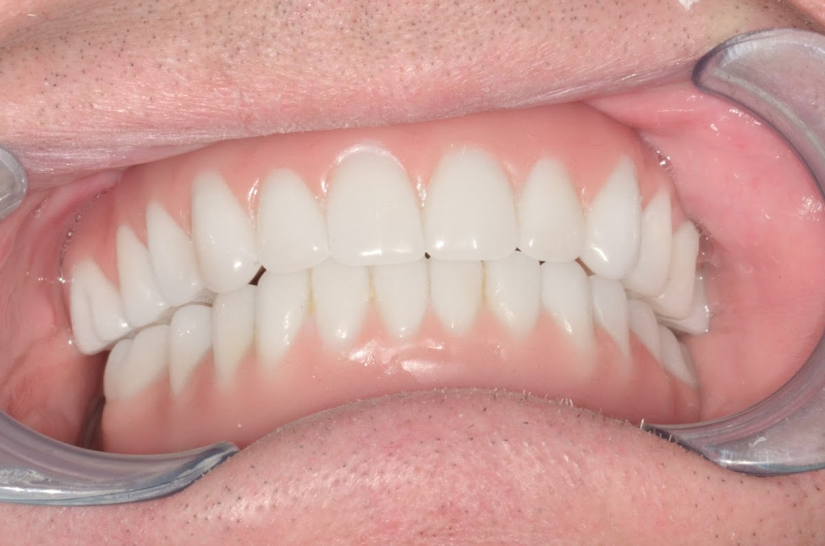 Memphis Dental Implant Surgery Center photo 2
