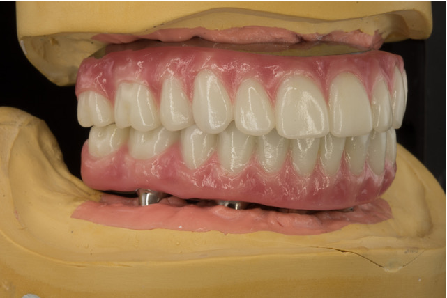 Memphis Dental Implant Surgery Center photo 4