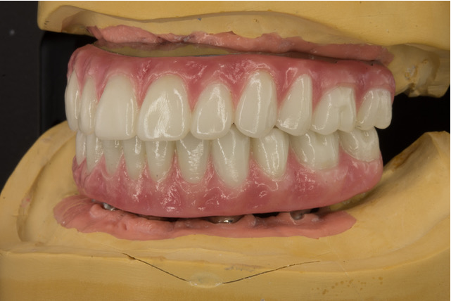 Memphis Dental Implant Surgery Center photo 5