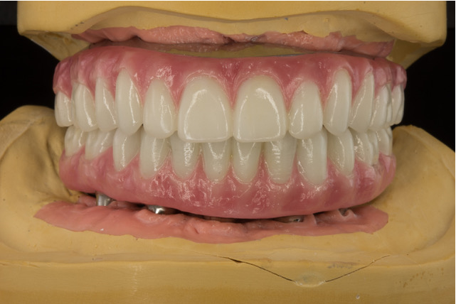 Memphis Dental Implant Surgery Center photo 6