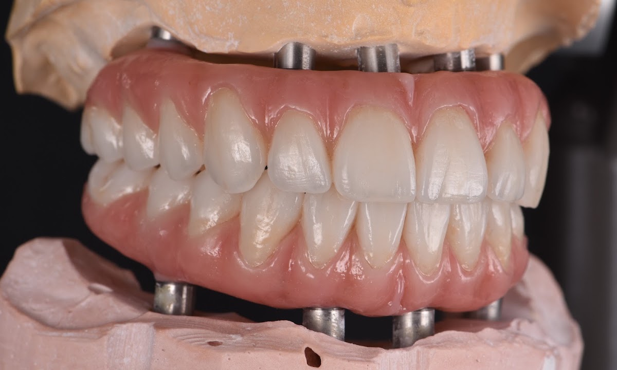Revive Dental and Implant Centers photo 2