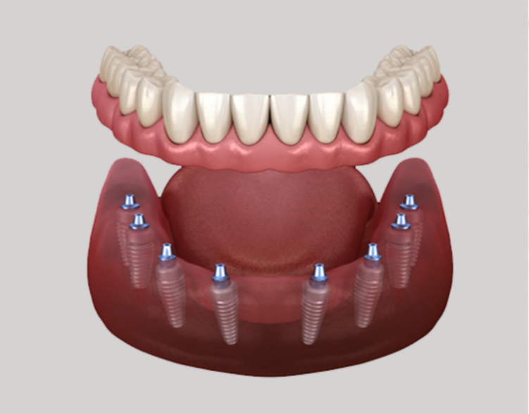 Kent Dental Implant Center photo 4