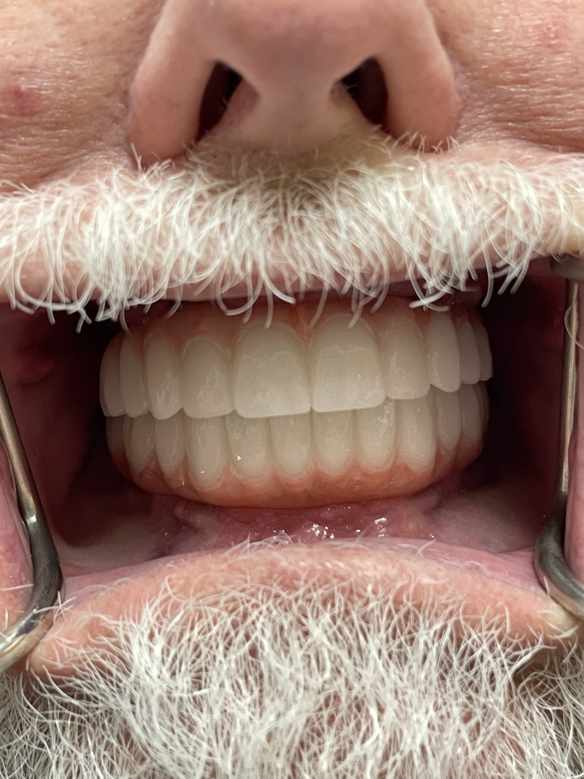 Upland Dental Group And Implant Center photo 4