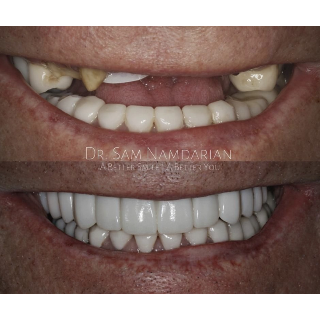 Sam Namdarian DMD, Fresno Smile Makeovers photo 3