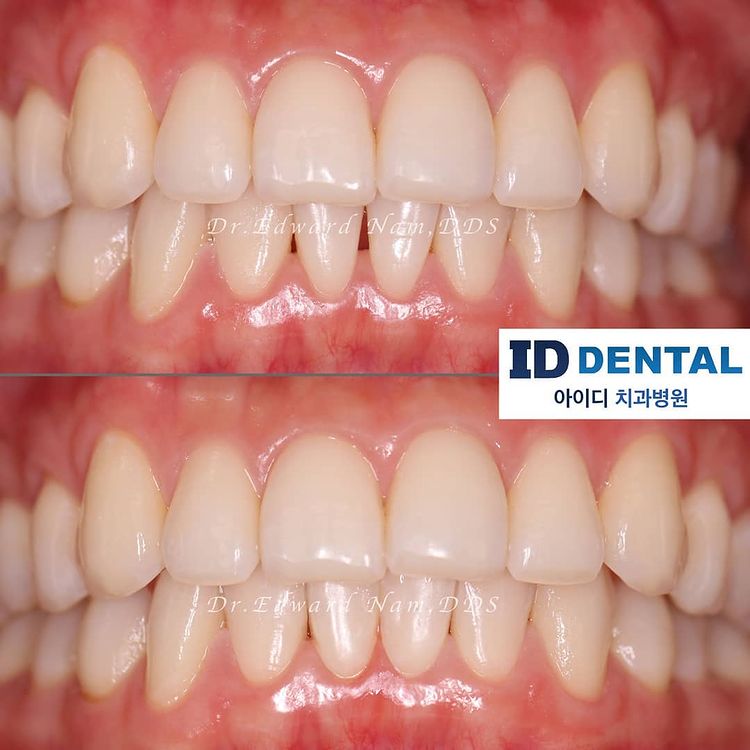Id Dental and Implant Center 아이디 치과 (임플란트, 교정, 미용, 일반 종합) photo 2