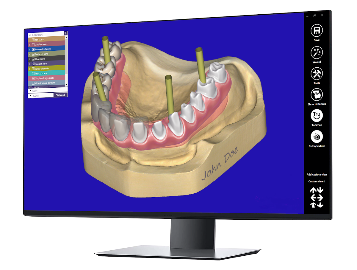 Westcoast Digital Denture and Implant Center photo 6