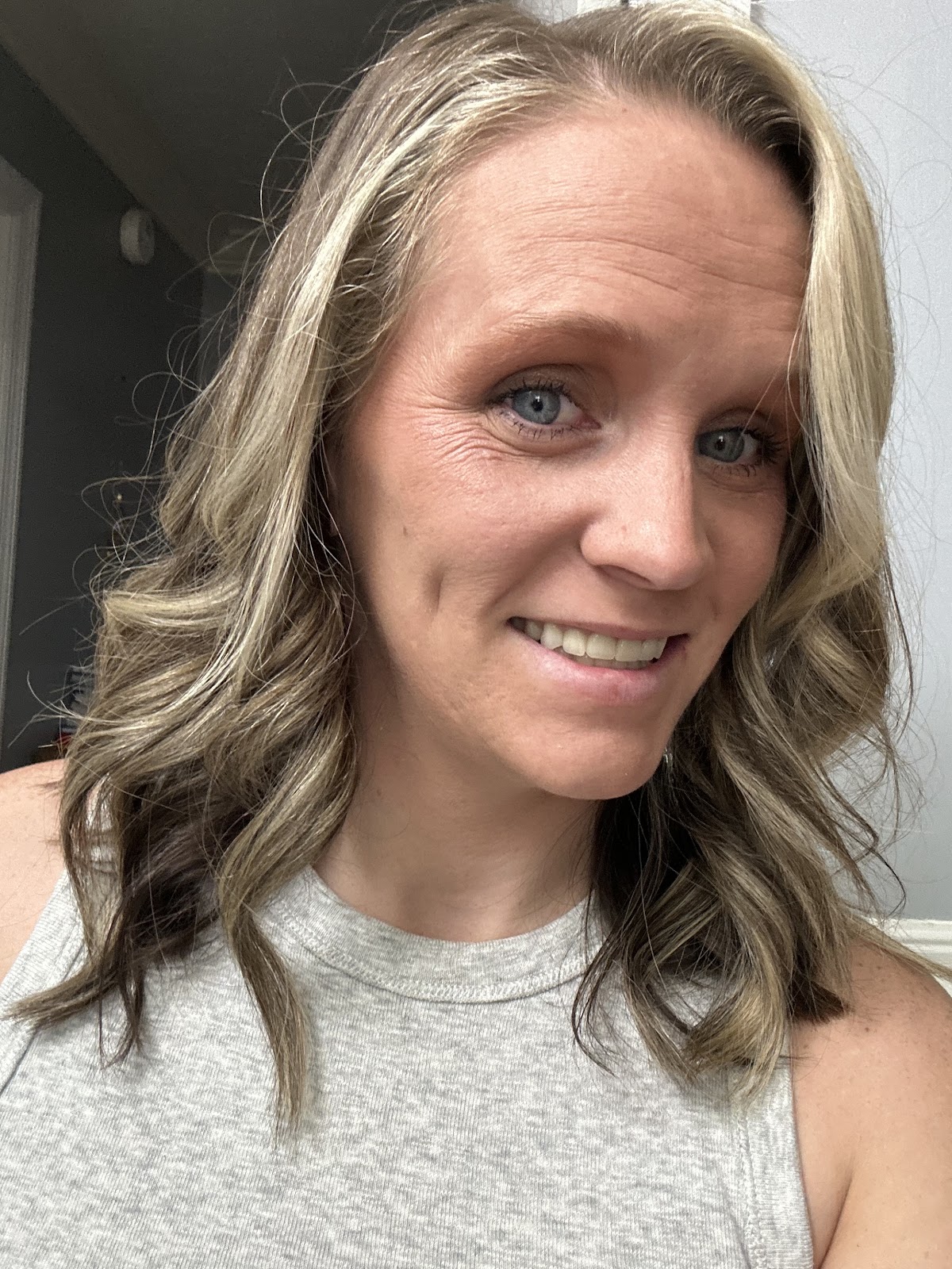 Affordable Dentures & Implants - Madison photo 6