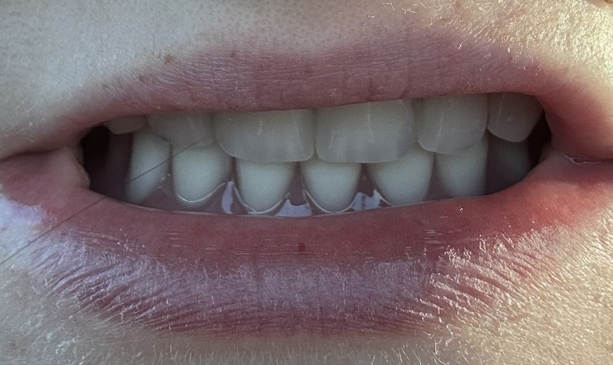 Aspen Dental - Conroe photo 4