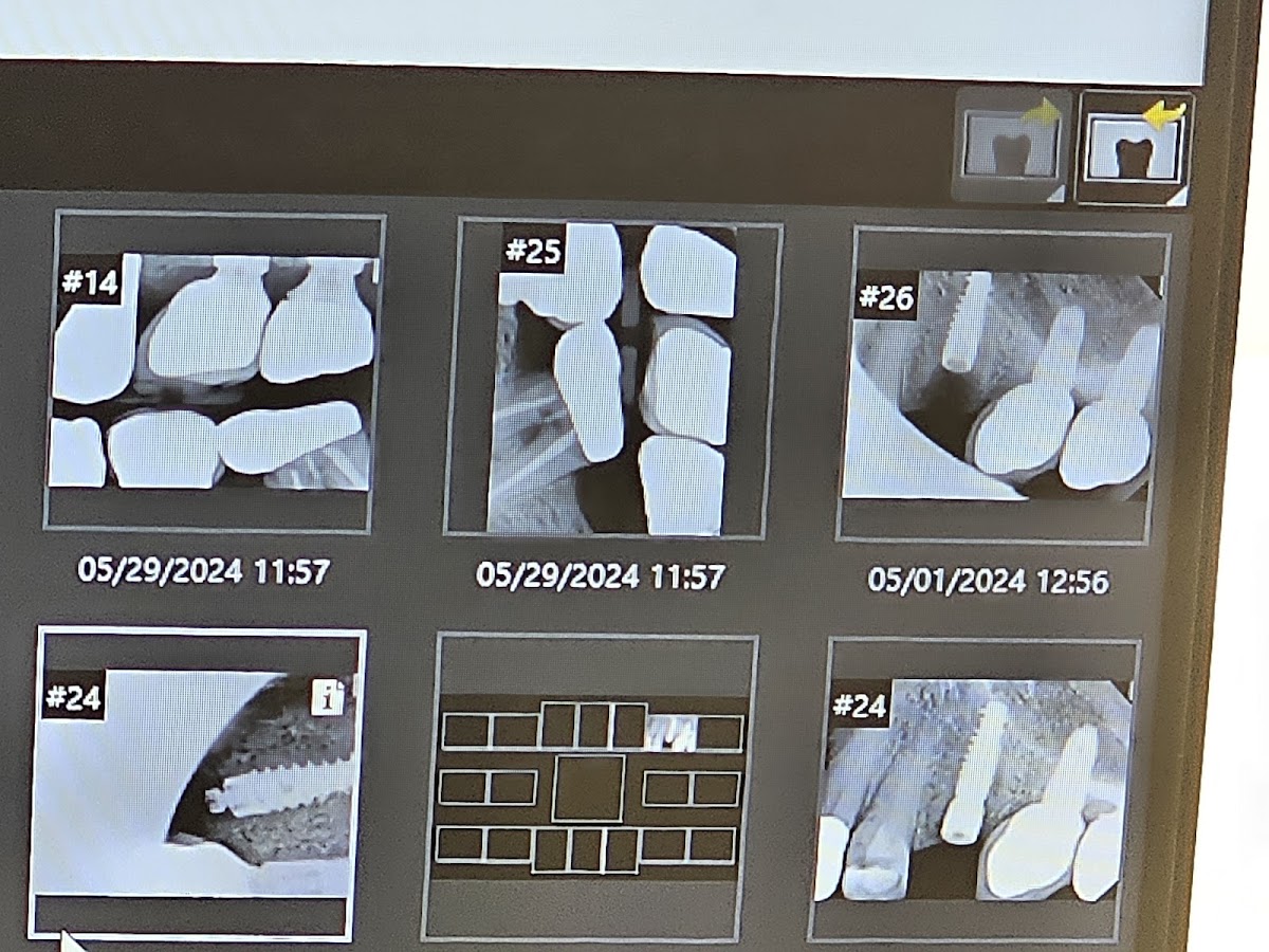 Aspen Dental - La Place photo 3
