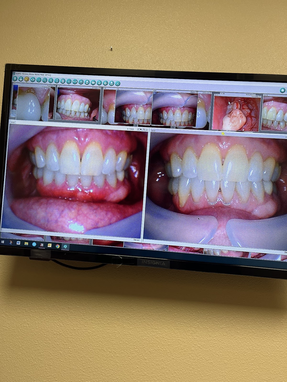 Implant & Periodontal Associates Nw - Richland photo 1