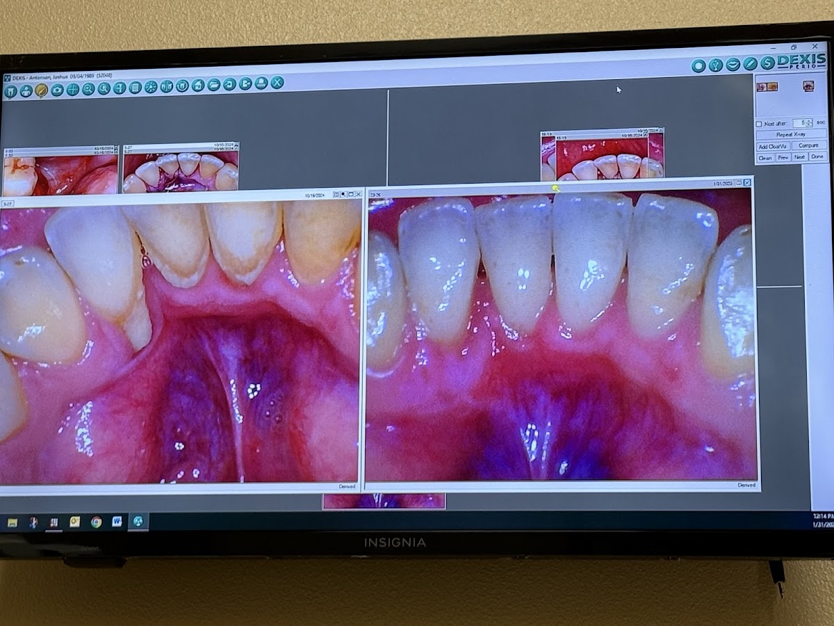 Implant & Periodontal Associates Nw - Richland photo 2