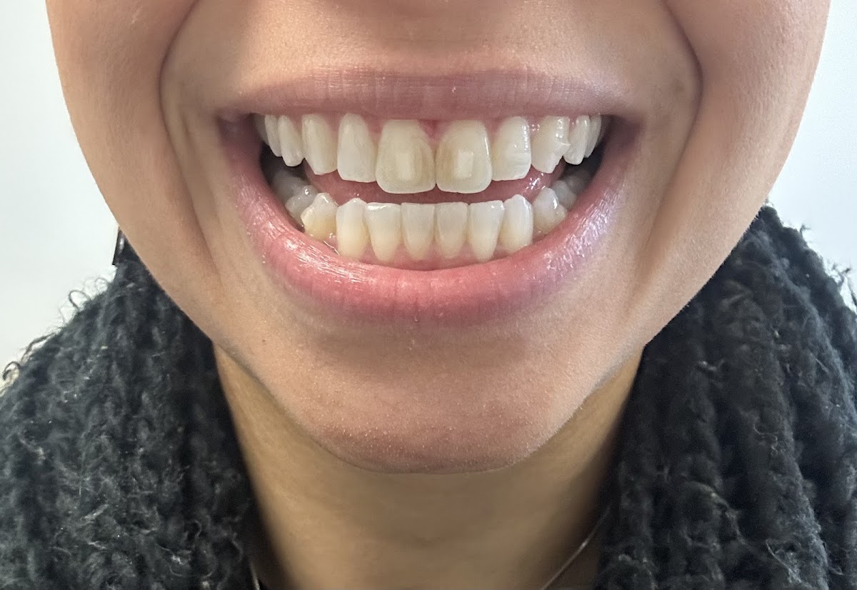 Zara Dental photo 6
